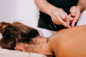 Acupuncture for Sports Injuries in Bath