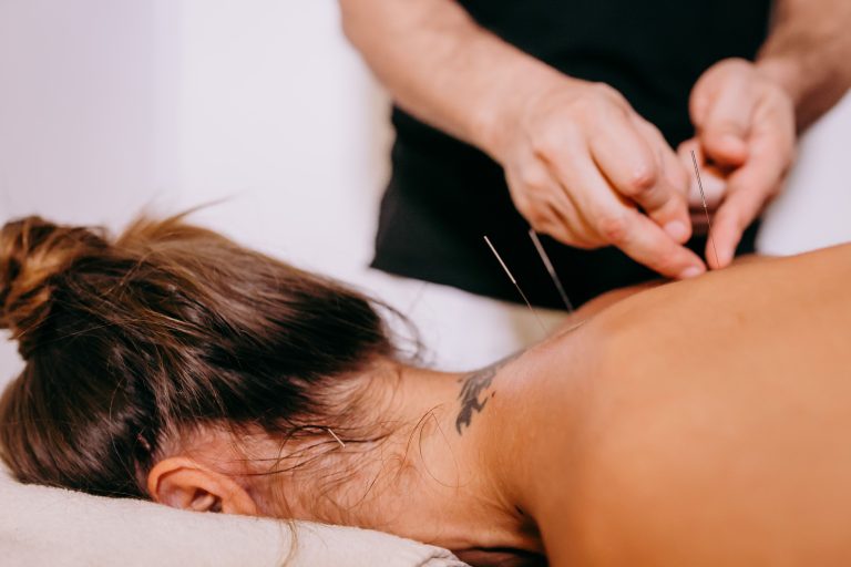 Acupuncture for Sports Injuries in Bath