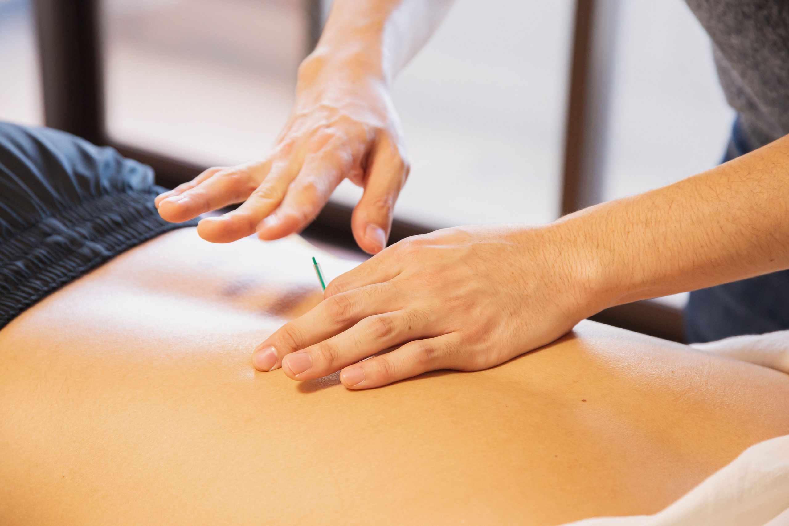 Acupuncture for Musculoskeletal Pain